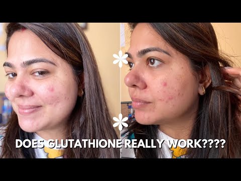 GLOWING SKIN SECRETS | Japanese Glutathione + VITAMIN C | PIGMENTATION | REDUCE DARKSPOTS CHICNUTRIX