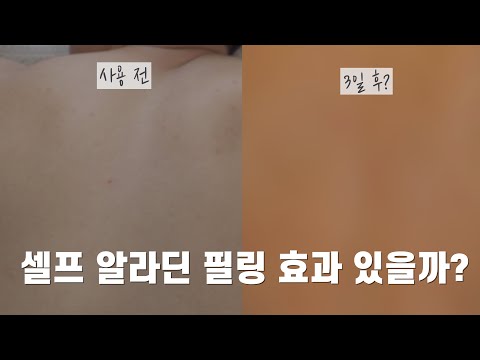 셀프 알라딘 필링 효과 있을까? feat.등드름