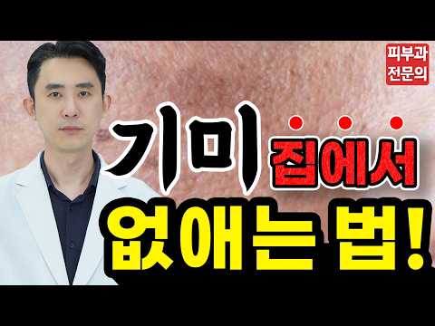 기미 집에서 없애는법! - 이 크림 성분을 쓰면 레이저 안해도 됩니다! 패치는 주의하세요!