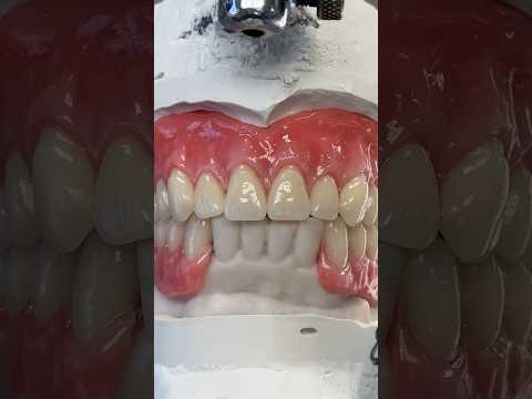 A prototype to replace grinder teeth #lsk121shorts #dentist #teeth