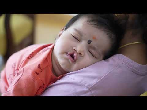 Cleft Lip Surgery Consultation for an Adorable Baby