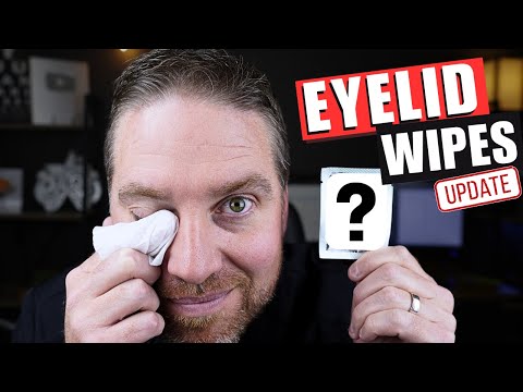 I Found the BEST Eyelid Wipes for Blepharitis and Dry Eyes 2025