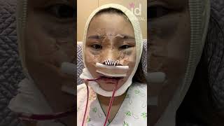 Plastic surgery transformation in Korea #idhospital #shorts