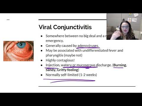 Bacterial and Viral Conjunctivitis