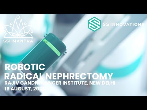 SSI Mantra - Radical Nephrectomy @ Rajiv Gandhi Cancer Institute and Research Center