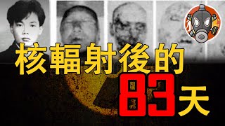 【東海村核臨界事故】染色體被破壞，皮膚全部脫落，世界上死法最恐怖的人｜獵奇小屋 The curiosity house