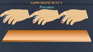 G6PD Deficiency