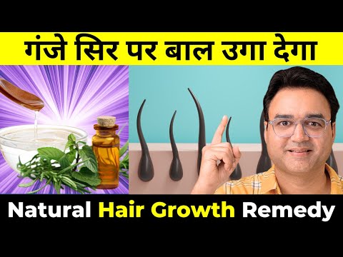 सिर्फ 4 बूंदे नारियल के तेल में मिला लो - गंजे सिर पर बाल उगा देगा | 2X Hair Growth Oil