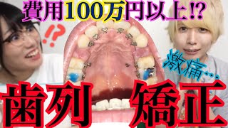 【赤裸々すぎる】歯列矯正の生の声【費用100万円以上⁉︎】