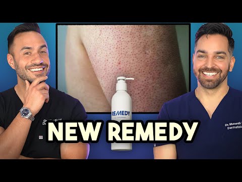 Keratosis Pilaris? Crepey Skin? New Product Alert from Remedy Science 🚨