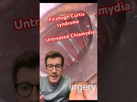 A complication of UNTREATED CHLAMYDIA or GONORRHEA #shorts