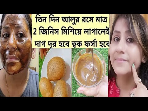 3 স্টেপের এই ফেসিয়াল ত্বক হবে দাগহীন ফর্সা উজ্জ্বল গ্লোউইং/Potato Facepack/Potato cream