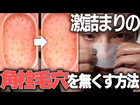 【男の毛穴角栓】これをやったら見違える程変わります。