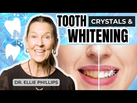 Does Tooth Whitening Damage Teeth?