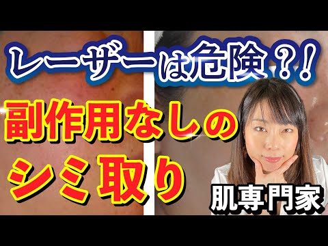 【エステサロン】ダウンタイムや副作用がない？！痛みがない？！シミケアの方法３つお伝えします！！