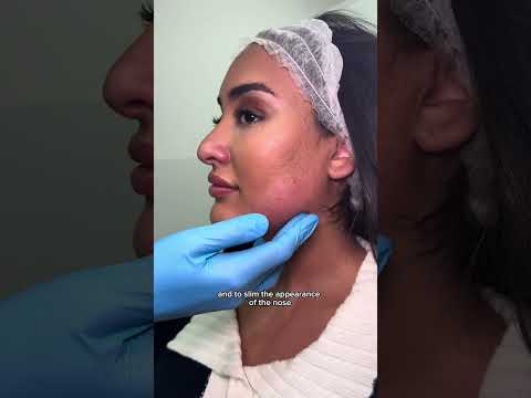 Botox To Slim the Nose and Jawline? YES, IT'S POSSIBLE! - DRMEDISPA