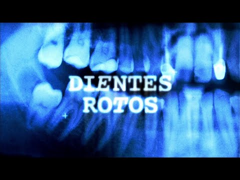 Vicente Calderón, Samantha Hudson - Dientes rotos