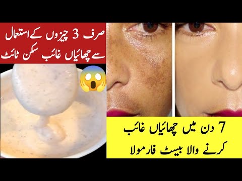 7 Days Remove Pigmentation | Pigmentation Removal at Home | 🌞 Suntan Removal Home Remedy |