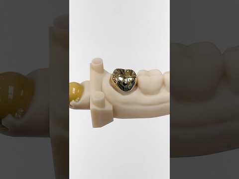 Amazing Gold Crown #lsk121shorts #dentist #teeth