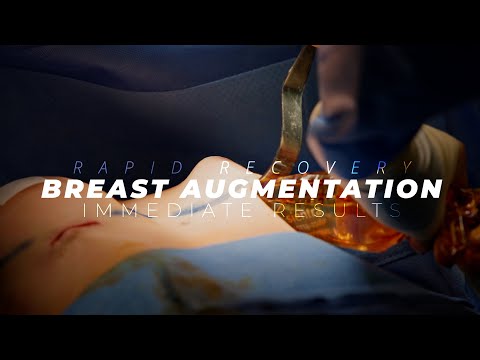 Rapid Recovery Breast Augmentation Immediate Surgery Result