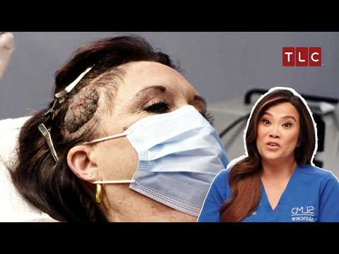 A Head Full of Worries! | Dr Pimple Popper TLC