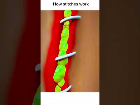 How stitches work #stitches