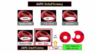 12DaysinMarch, G6PD Deficiency for the USMLE Step One Exam