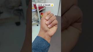 I HAVE 4 FINGER 🤘#viral #shorts#trending #trendingshorts #ytshorts #ytviralvideo #music #plzsupport