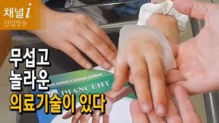 [Tech Fun]  Amazing medical technology  무섭고 놀라운 의료기술이 있다 !!!   [산업방송 채널i]