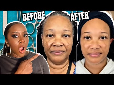 Reacting to VIRAL Face Lifts on Mostly Black and Brown Skin