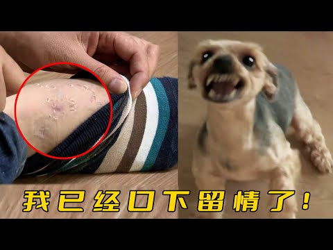 工作人員被狗連咬8口，腳背全是皮屑淤青，訓犬師卻說狗不是故意的