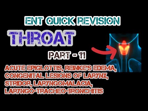 Understanding Acute Epiglottis, Reinke's Edema, Congenital Lesions Of Larynx | Dr. Deen Lectures