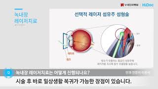 녹내장 레이저치료는 어떻게 진행되나요 / 누네안과병원 녹내장센터 이원석 원장