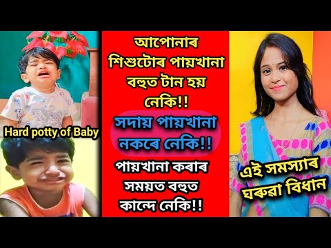 আপোনাৰ শিশুৱে বহুত দিন যদি পায়খানা নকৰে,পায়খানা যদি টান হয় তেন্তে কি কৰিব ||Hard Potty of Baby||