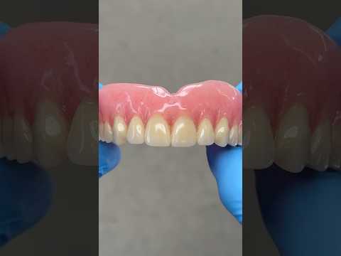 Amazing Process Denture #lsk121shorts #dentist #teeth