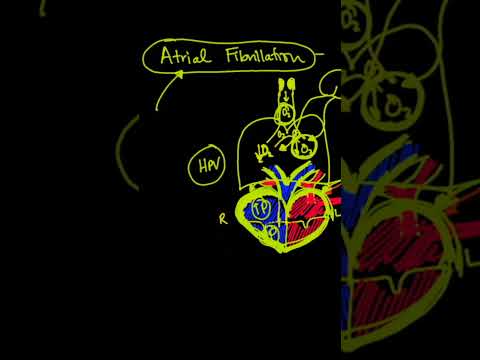 Sleep apnea and abnormal heart rhythm