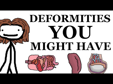 Deformities That You Might Have