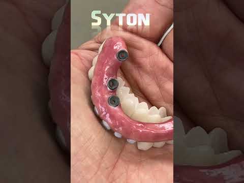 Another incredible SYTON restoration to give another excited patient a new smile.