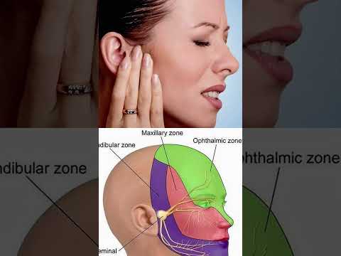 Best Trigeminal Neuralgia Treatment in Coimbatore