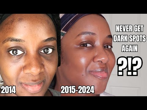 How I almost NEVER get DARK SPOTS