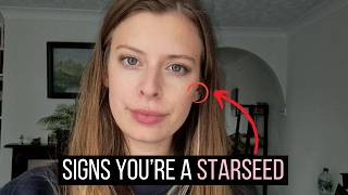 What Is A Starseed & 50 Signs You Are One | Starseed Quiz