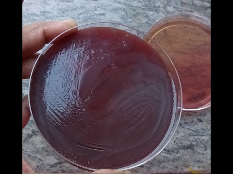 Microbiology Practicals Spotter 8 (For Micro MD/DNB PG's, MBBS, BDS, BPT, MSc, DMLT)