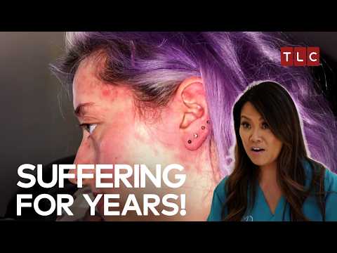 The Unsolvable Skin Condition! | Dr Pimple Popper TLC