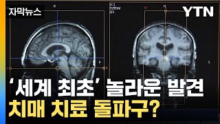 [자막뉴스] 국내 연구진의 놀라운 발견...'치매 치료' 돌파구 될까 / YTN