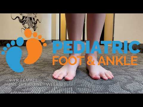 9 Year Old Girl's Toe Walking Journey to Recovery with Dr. Jarman