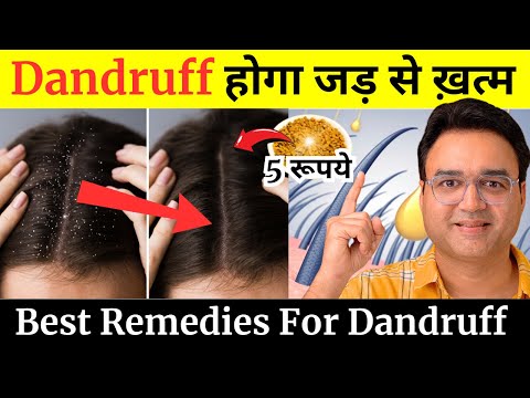 5 चीज़ें जिनसे Dandruff होगा जड़ से ख़त्म | Home Remedies For Dandruff