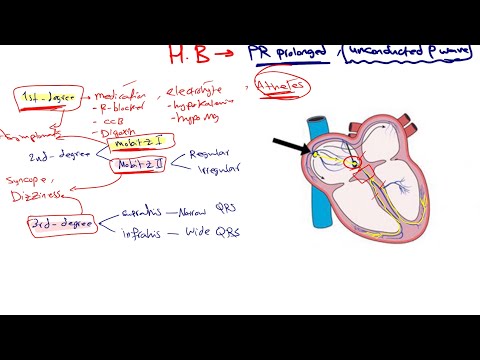 CASE_5 Heart block