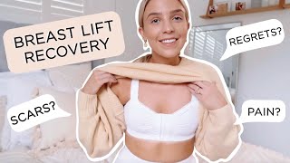 Breast Lift Recovery/ Scars? Pains? Any Regrets? Internal Bra? / Answering all Your Questions