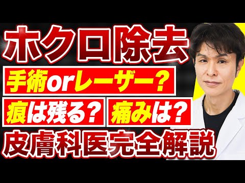 ホクロ除去Q&A：美肌を手に入れるための必須情報を皮膚科専門医が解説