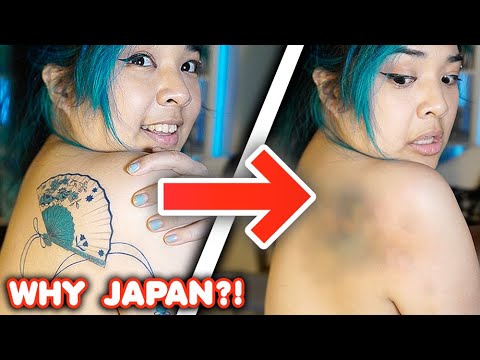 I Tried to Get Rid of My Tattoo...